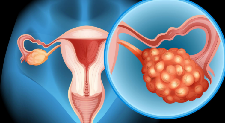 国内地下供卵,试管婴儿最难的那一关(试管婴儿是怎么做的)