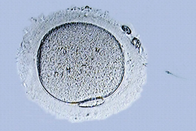 国内捐卵医院,无创、绒毛、羊穿哪个好?先分清区别再做选择