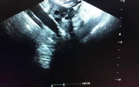 国内生殖试管供卵医院,三亚精子库筛查，海南捐精最高可获补助5150元