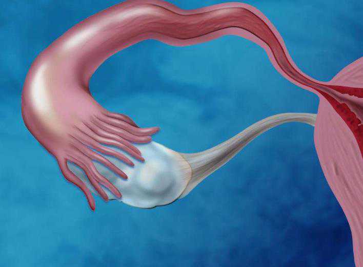 国内借卵代怀,试管移植生化怎么办