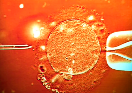 国内捐卵机构中介,衡南县父子亲子鉴定需要多少时间出结果